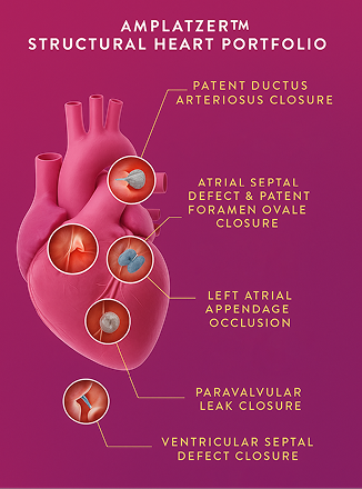 Abbott Structural Intervention